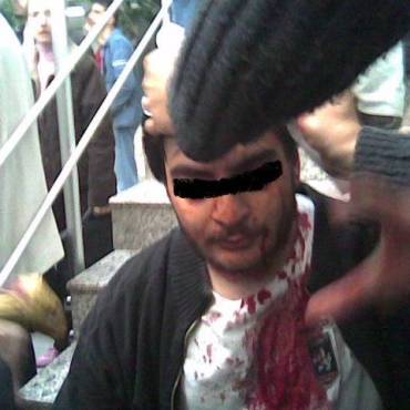 PKK'lıların demir sopalarla yaraladığı arkadaşlardan birisi